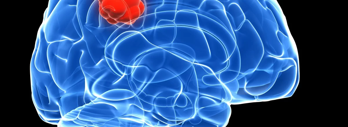 icd 10 code for brain tumor removal