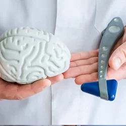 Services 12 اضطرابات الحركة وجراحات الصرع