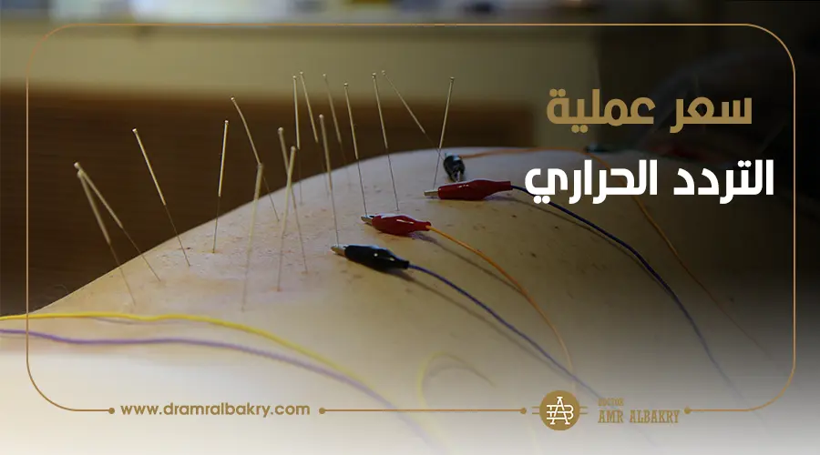 سعر عملية التردد الحراري