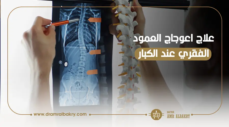 علاج اعوجاج العمود الفقري عند الكبار