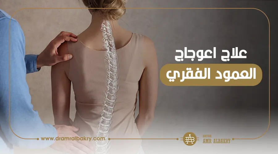 اعوجاج العمود الفقري عند الاطفال ( الجنف ) | الأسباب، الأعراض، والعلاج