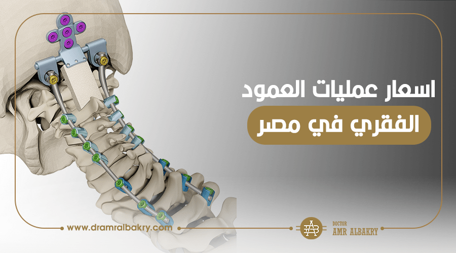جراحة العمود الفقري في مصر