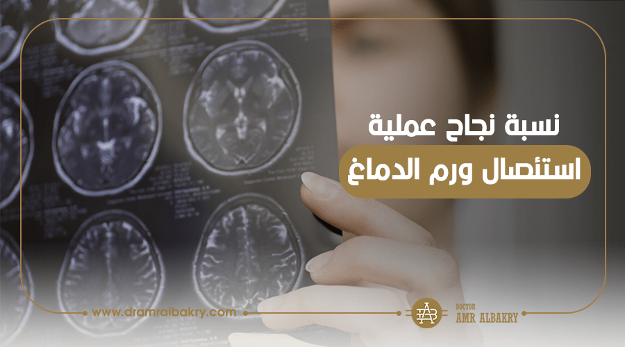نسبة نجاح عملية استئصال ورم الدماغ