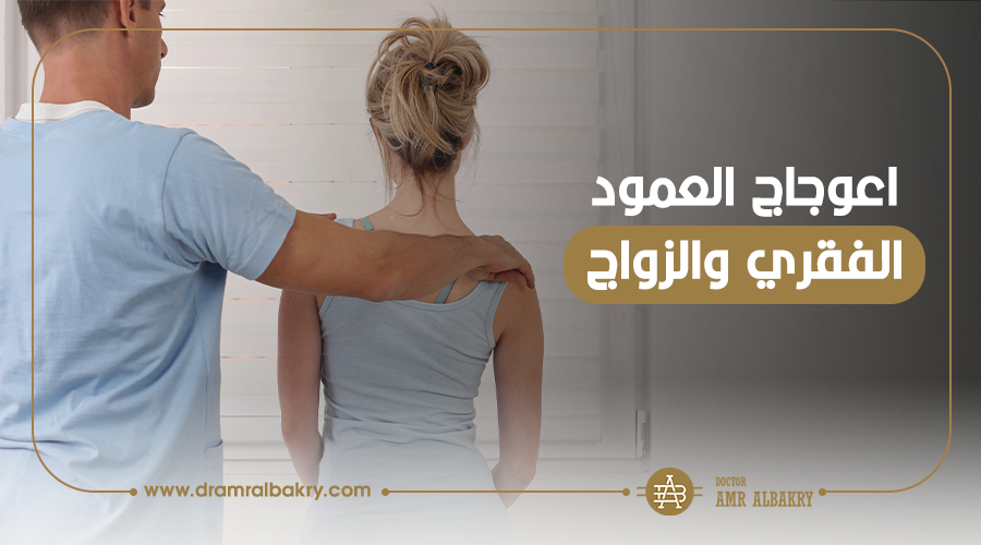 اعوجاج العمود الفقري والزواج