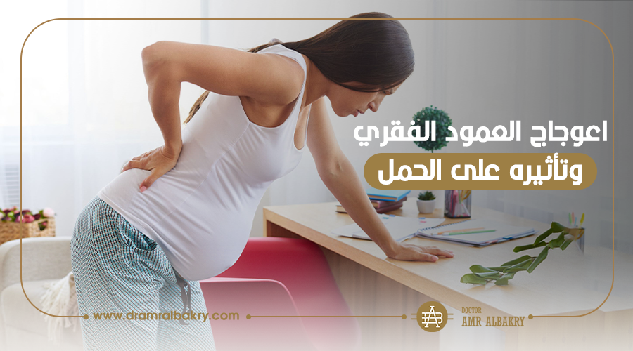 اعوجاج العمود الفقري وتأثيره على الحمل والولادة الطبيعية