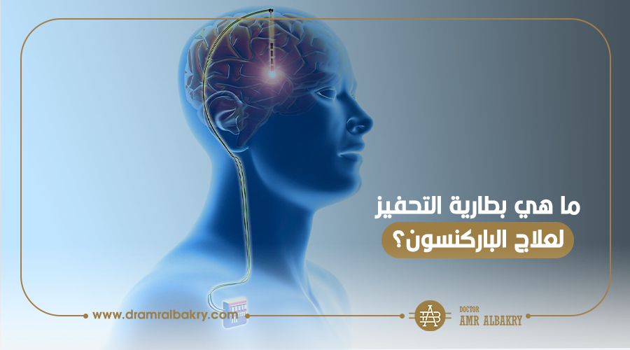 بطارية التحفيز العميق