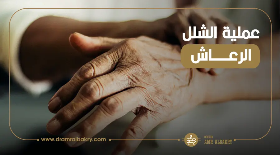 اطلب عملية الشلل الرعاش مع دكتور عمرو البكري افضل دكتور مخ واعصاب في مصر 1 عملية الشلل الرعاش