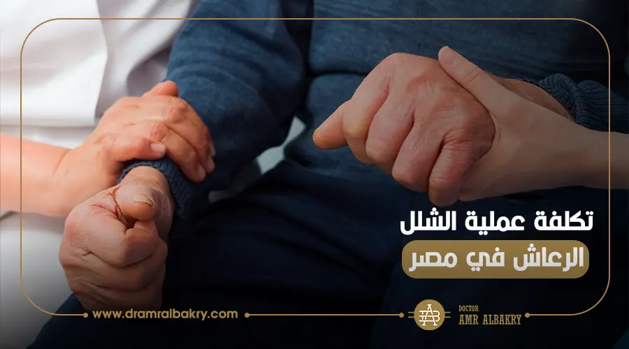 تكلفة عملية شلل الرعاش في مصر