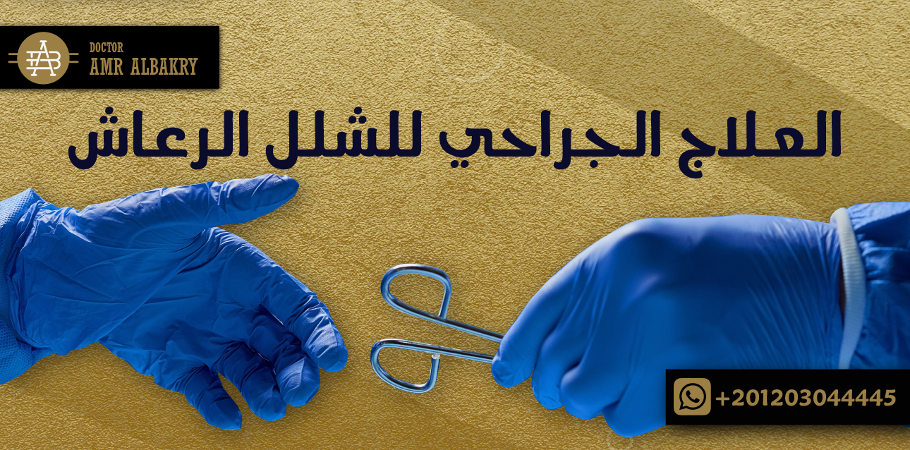 العلاج الجراحي للشلل الرعاش