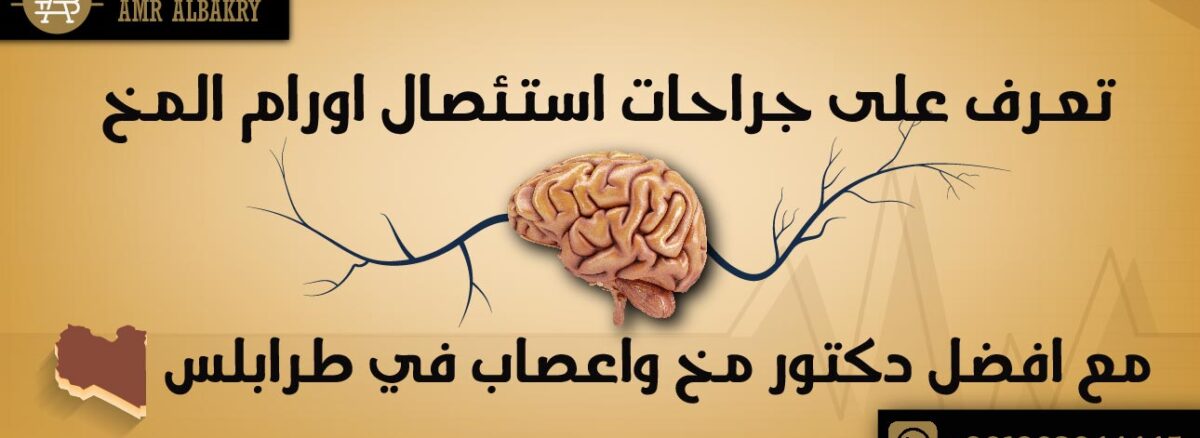 تعرف على جراحات استئصال اورام المخ مع افضل دكتور مخ واعصاب في طرابلس