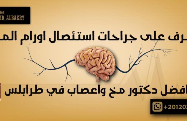 تعرف على جراحات استئصال اورام المخ مع افضل دكتور مخ واعصاب في طرابلس