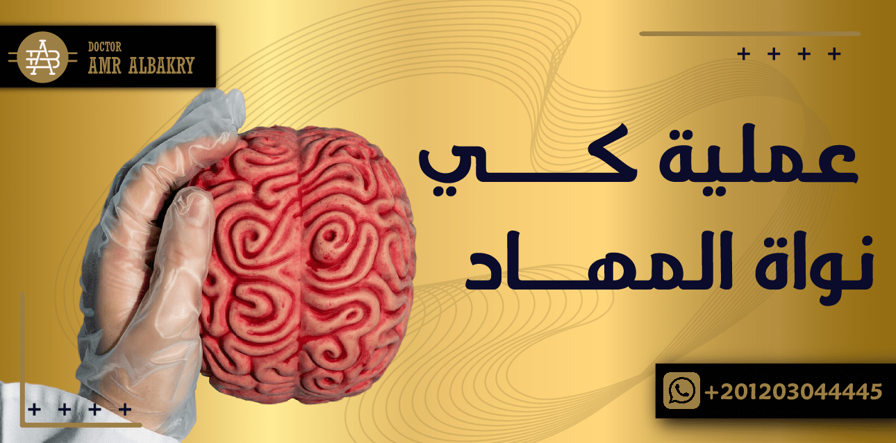 تعرف على علاج الشلل الرعاش عن طريق عملية كي نواة المهاد فى مصر