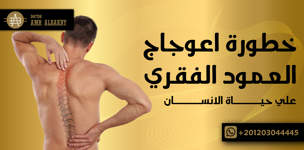 خطورة اعوجاج العمود الفقري