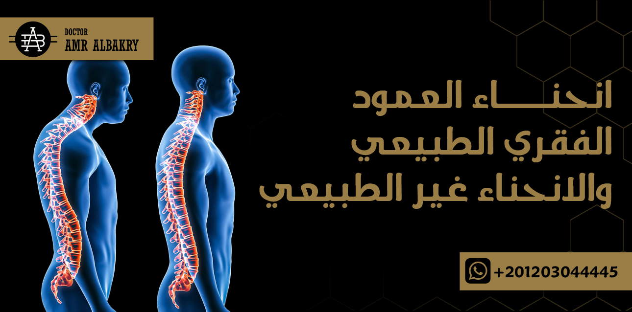 انحناء العمود الفقري