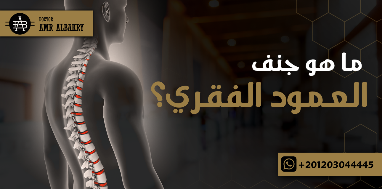 جنف العمود الفقري