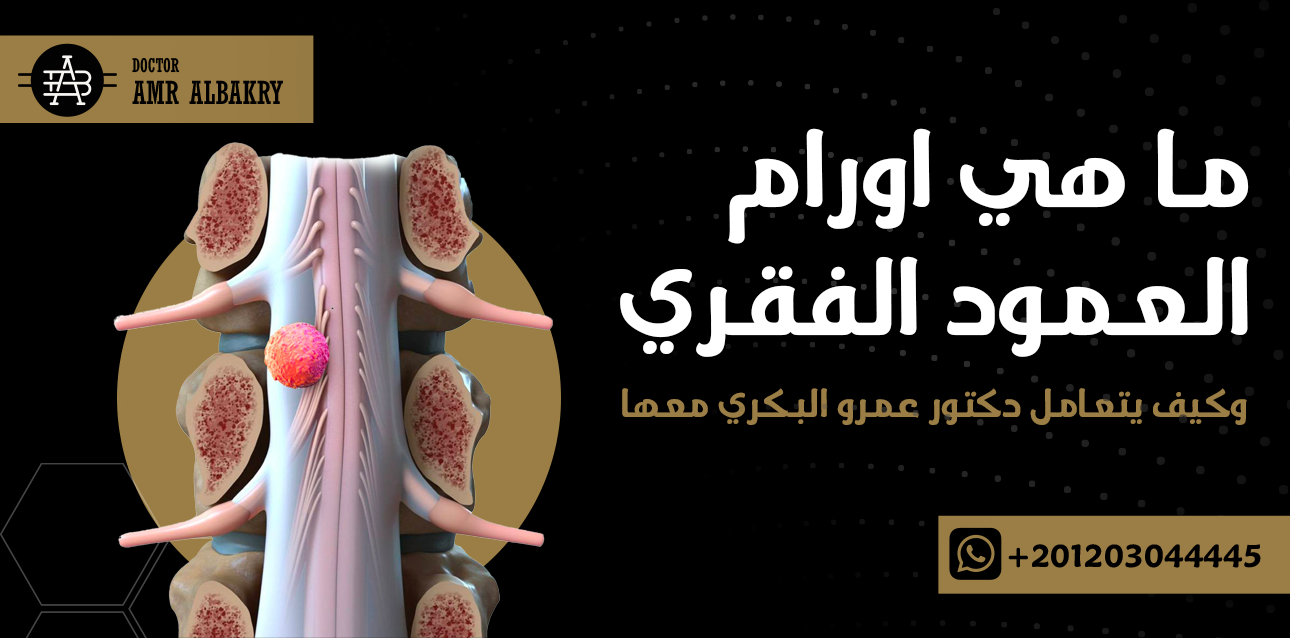 اورام العمود الفقري