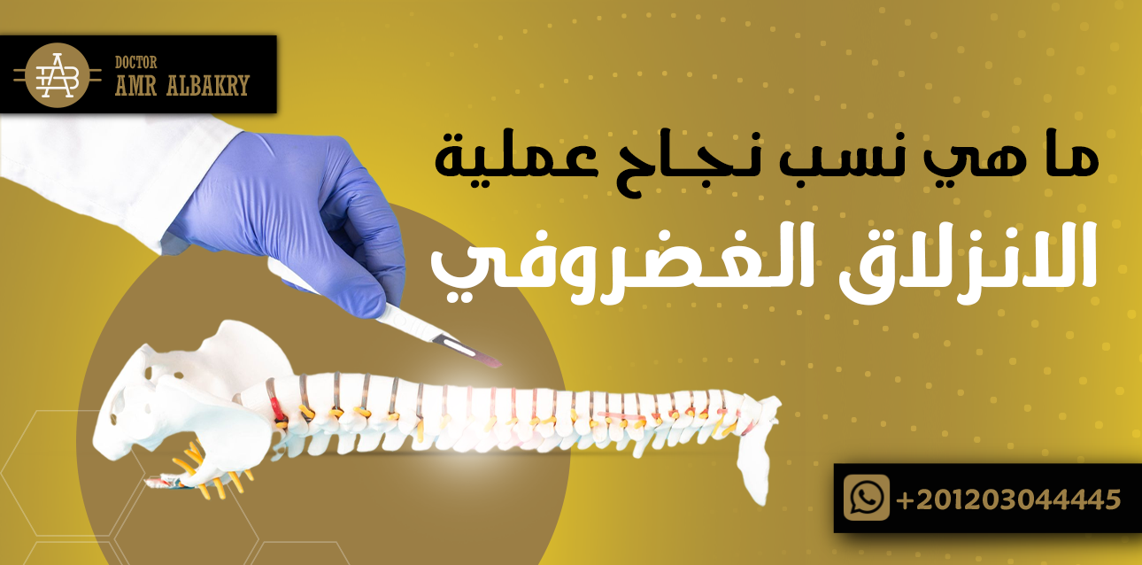 نسبة نجاح عملية الانزلاق الغضروفي