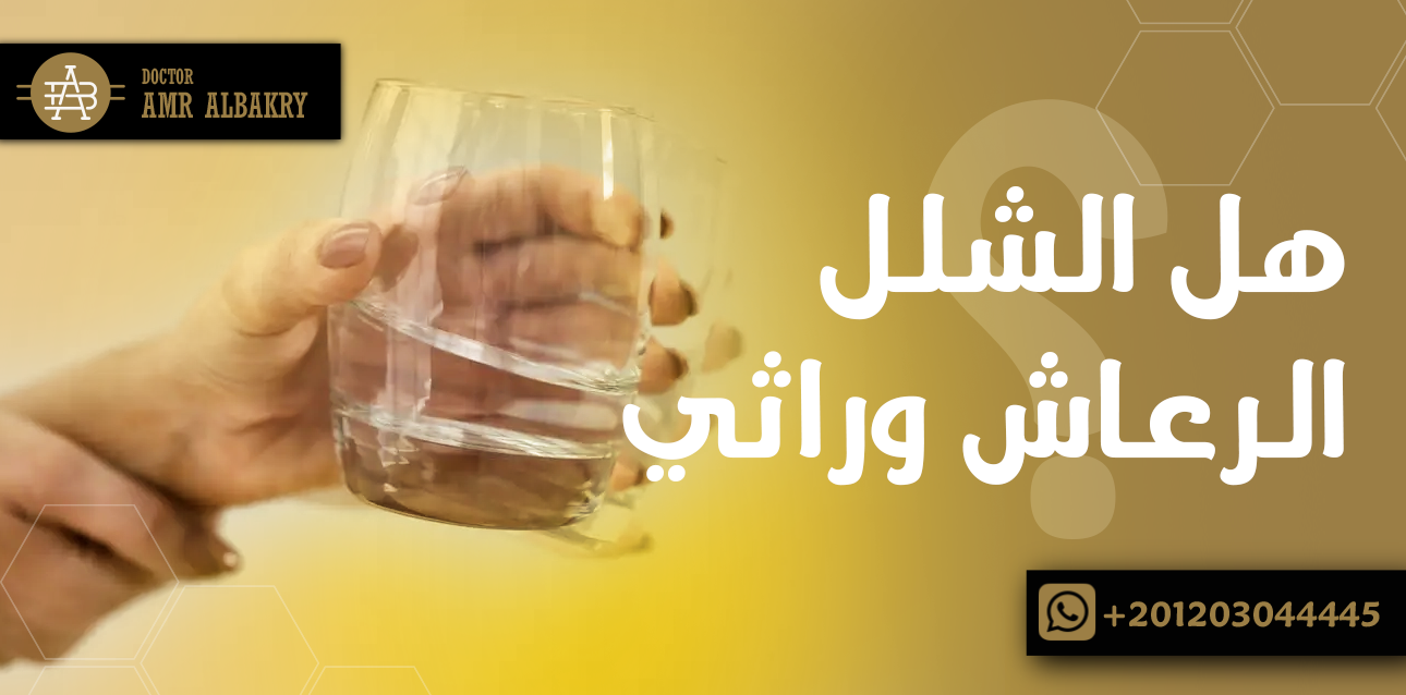 الشلل الرعاش وراثي