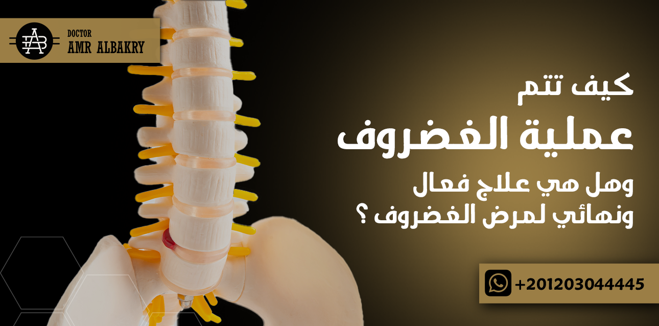 عملية الغضروف