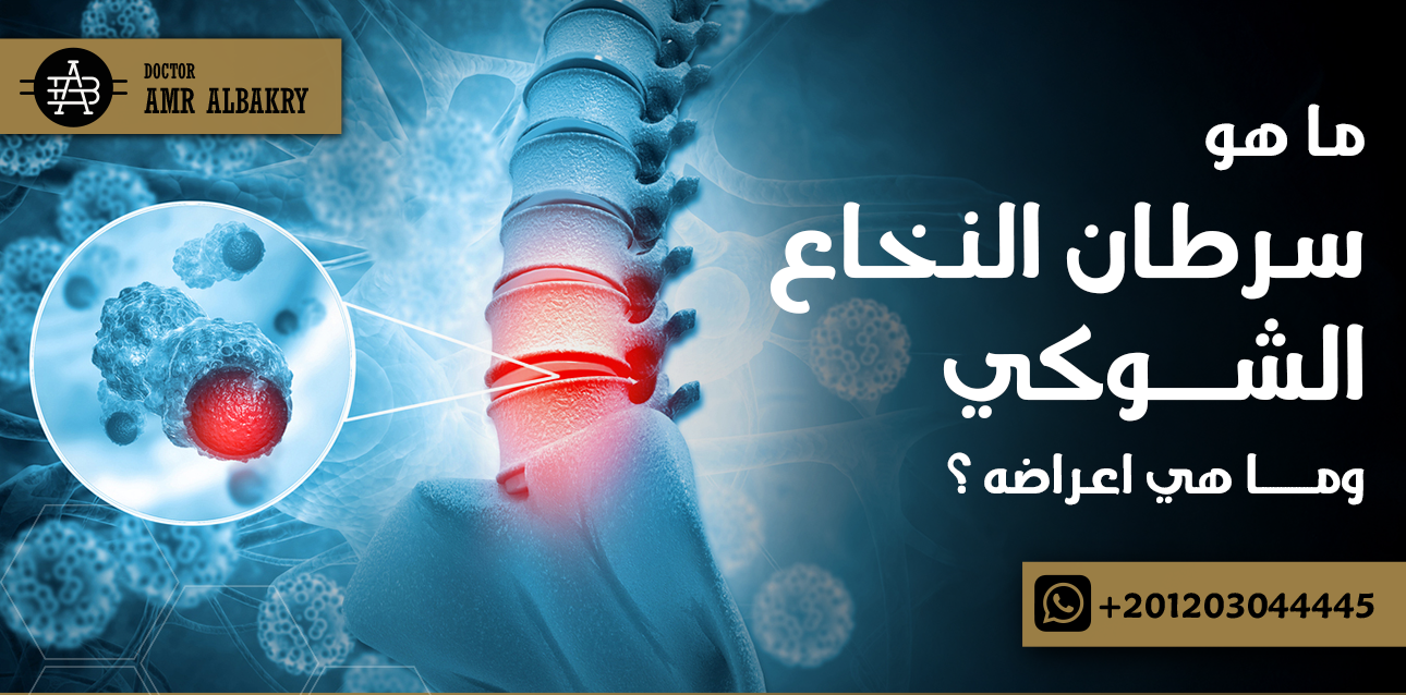 سرطان النخاع الشوكي