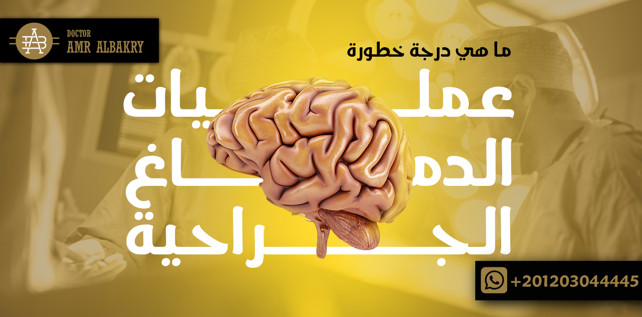 خطورة عمليات الدماغ الجراحية