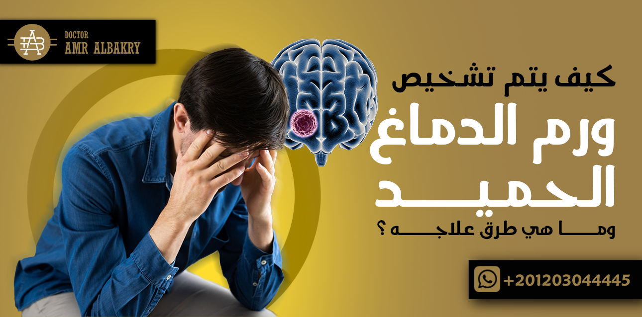 ورم الدماغ الحميد