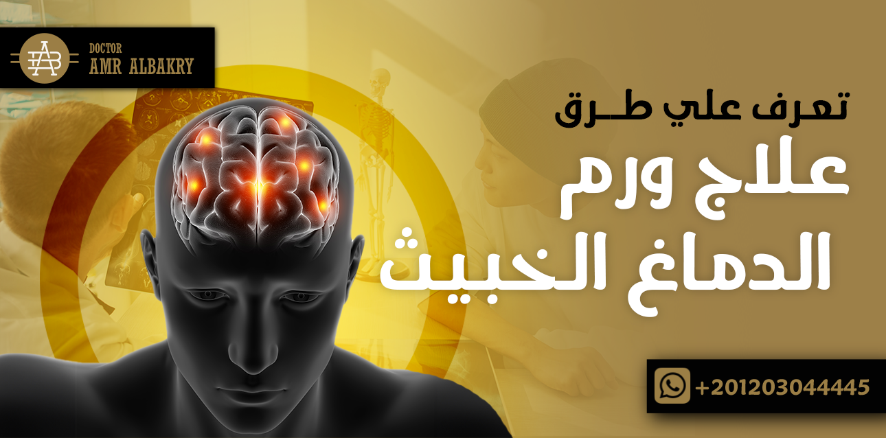 ورم الدماغ الخبيث