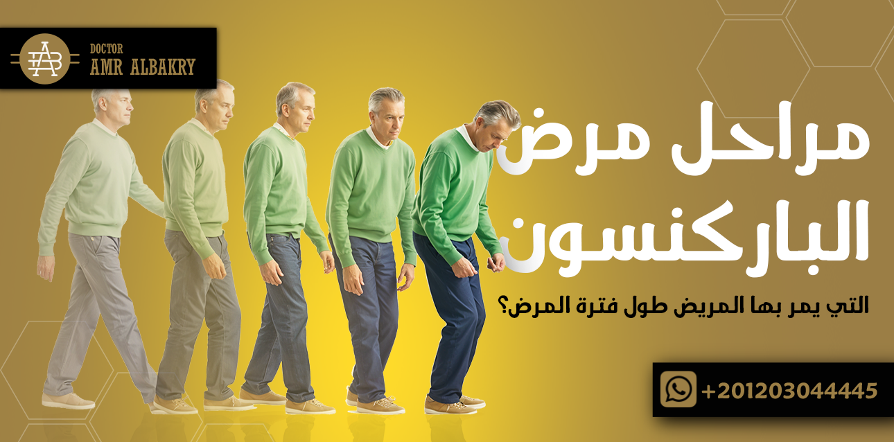 مراحل مرض الباركنسون