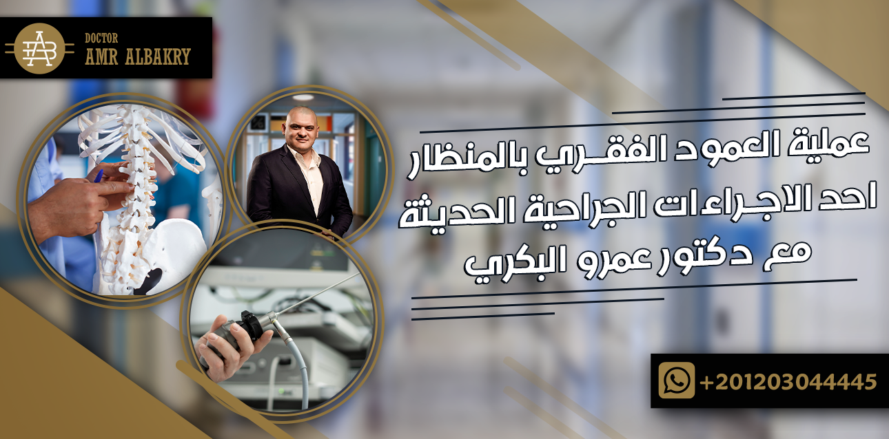 عملية العمود الفقري بالمنظار