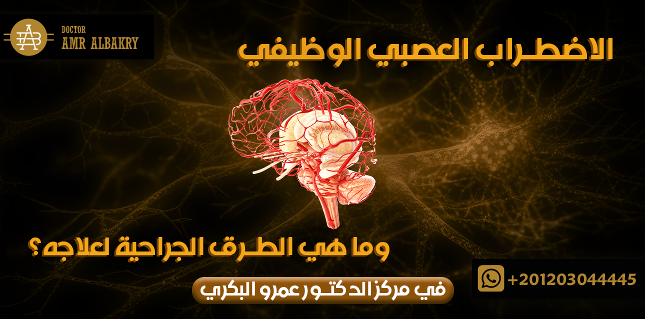 الاضطراب العصبي الوظيفي