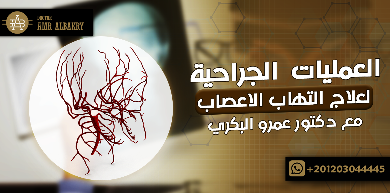 التهاب الاعصاب