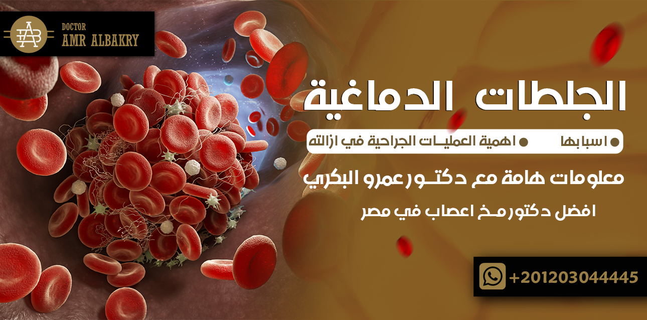 الجلطات الدماغية