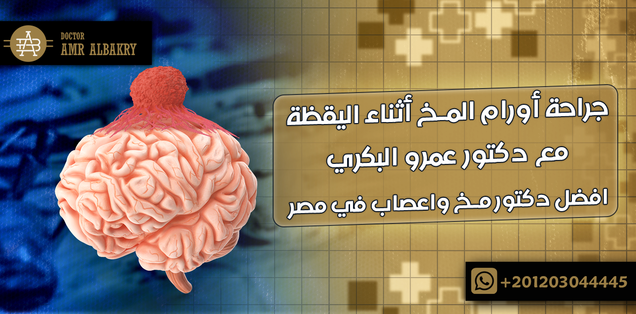 جراحة أورام المخ أثناء اليقظة