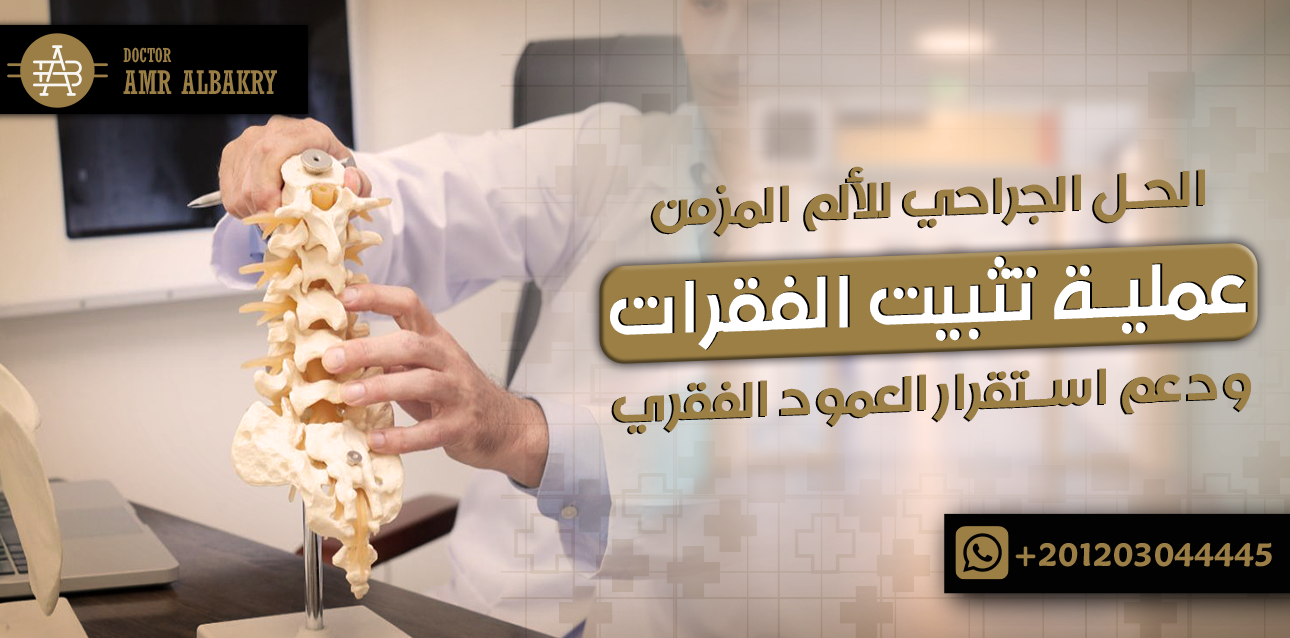 عملية تثبيت الفقرات