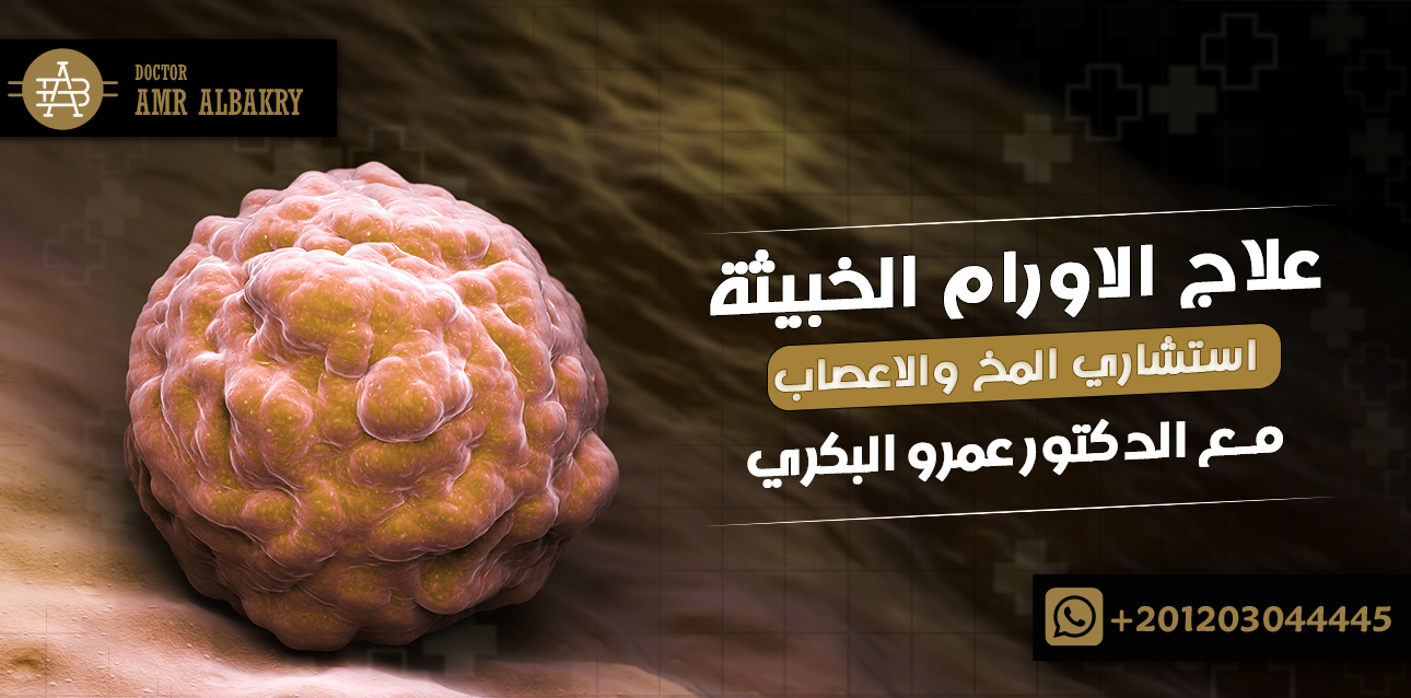 استشاري المخ والاعصاب