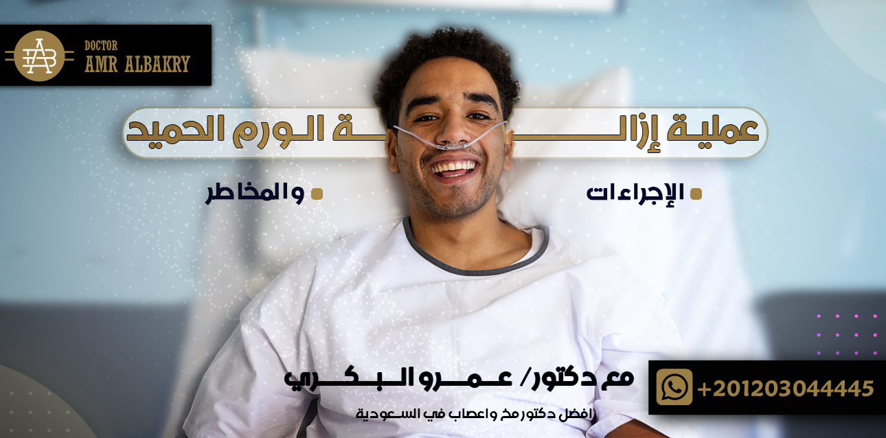 عملية إزالة الورم الحميد