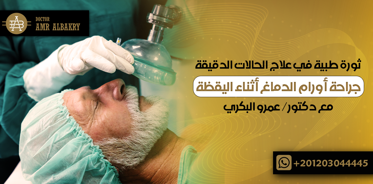 جراحة أورام الدماغ أثناء اليقظة