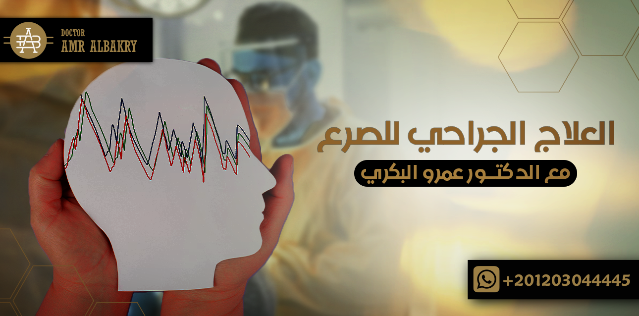 العلاج الجراحي للصرع