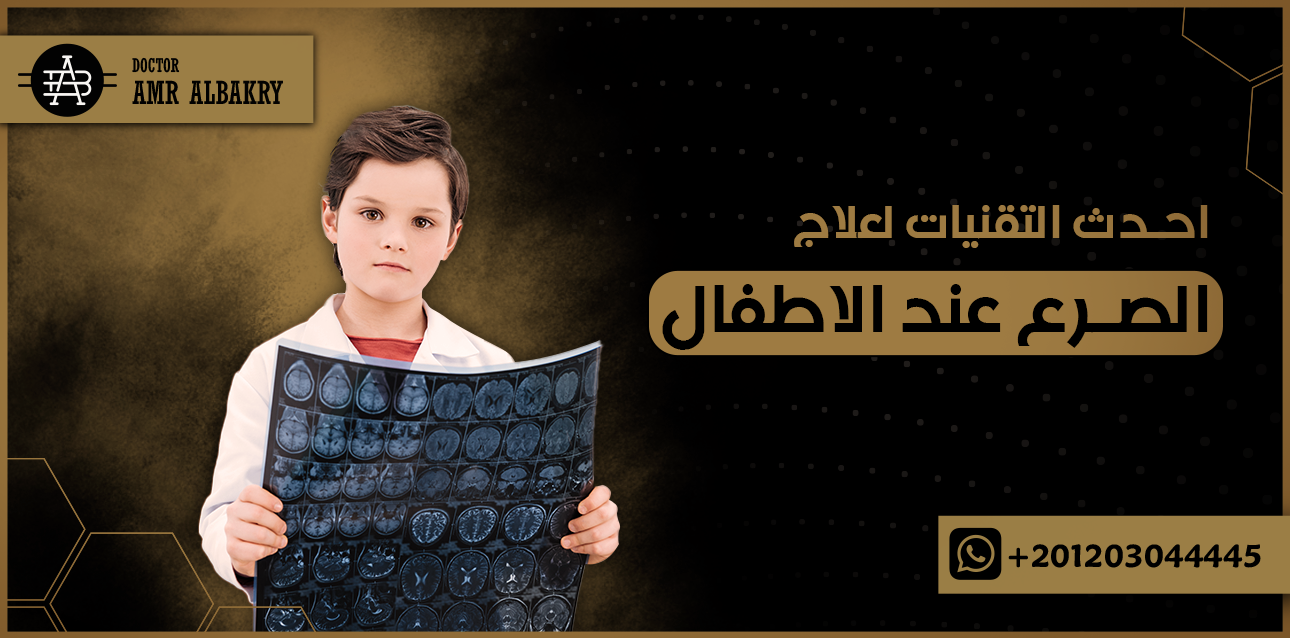 علاج الصرع عند الاطفال