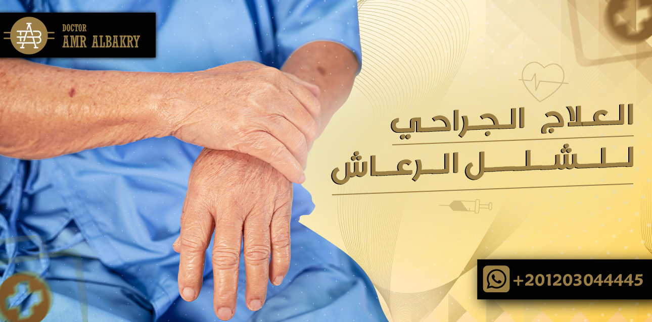 العلاج الجراحى للشلل الرعاش