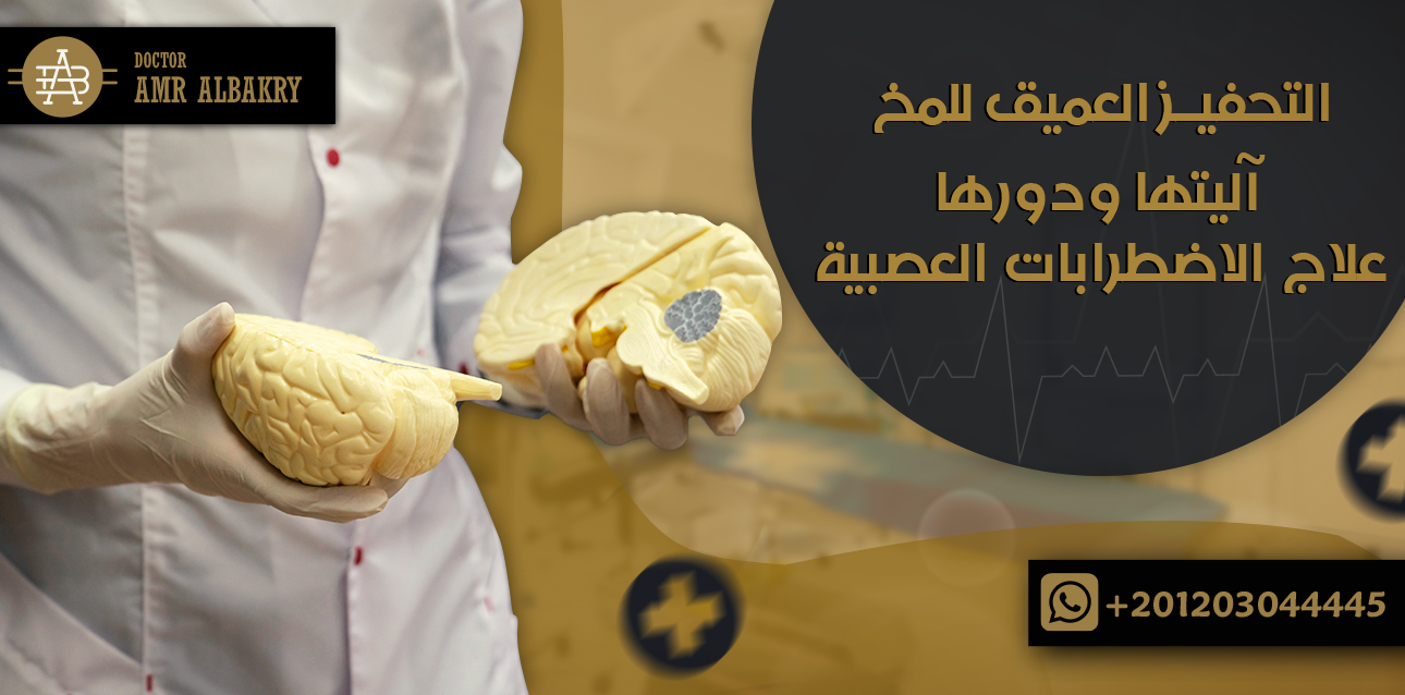 عملية التحفيز العميق للمخ