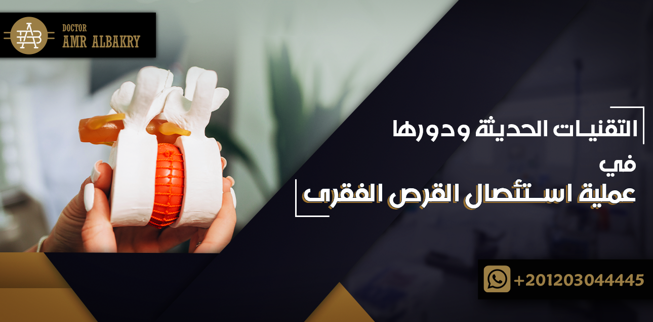 استئصال القرص الفقرى