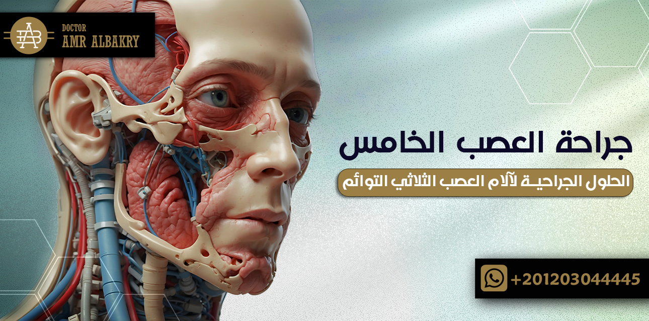 جراحة العصب الخامس