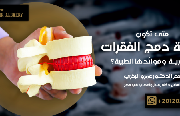 جراحة دمج الفقرات