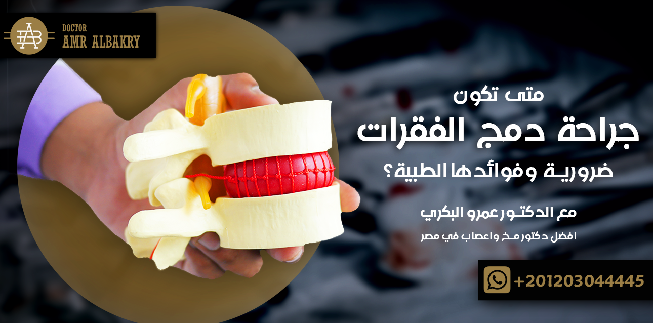 جراحة دمج الفقرات