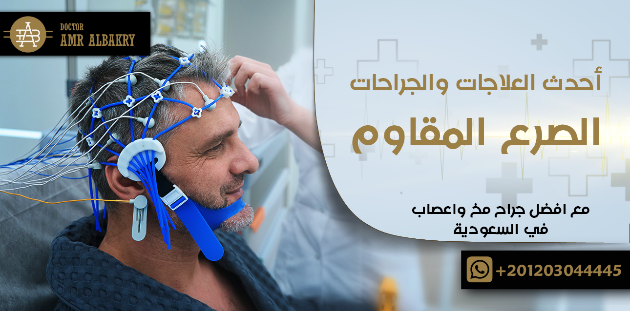 الصرع المقاوم