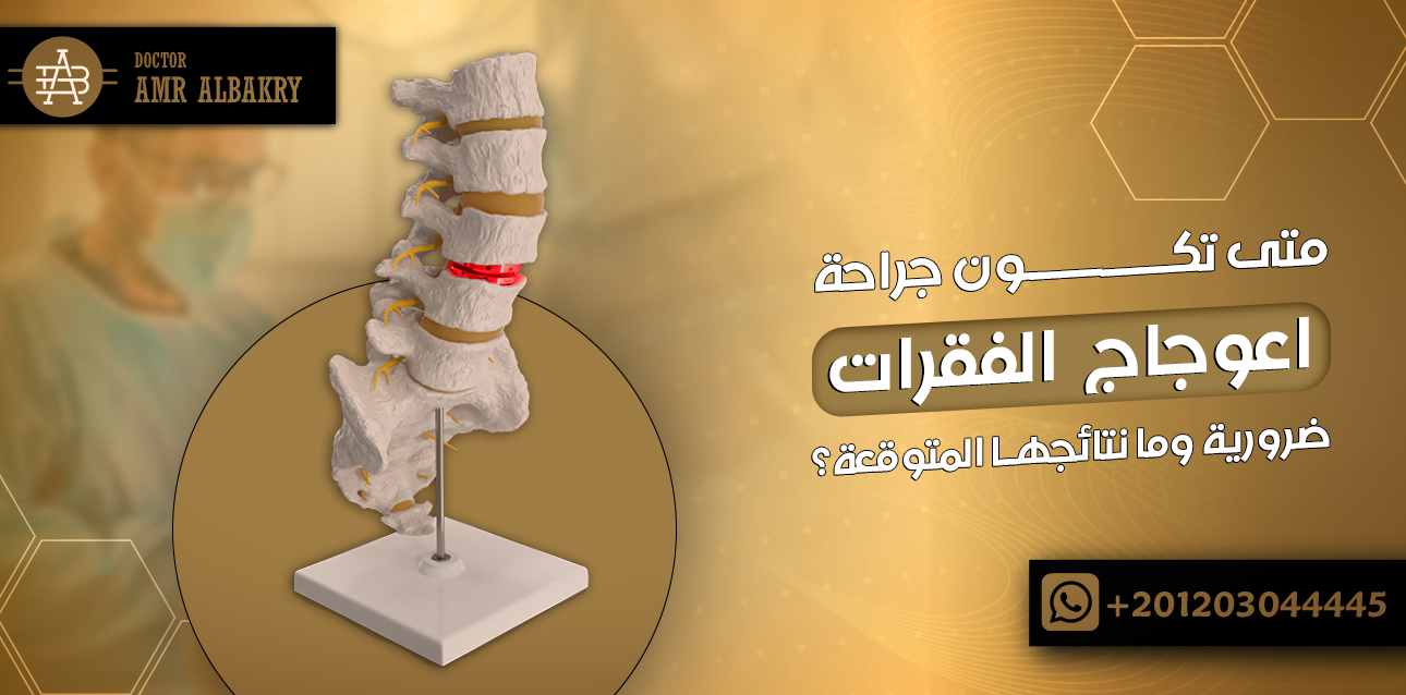 جراحة اعوجاج الفقرات