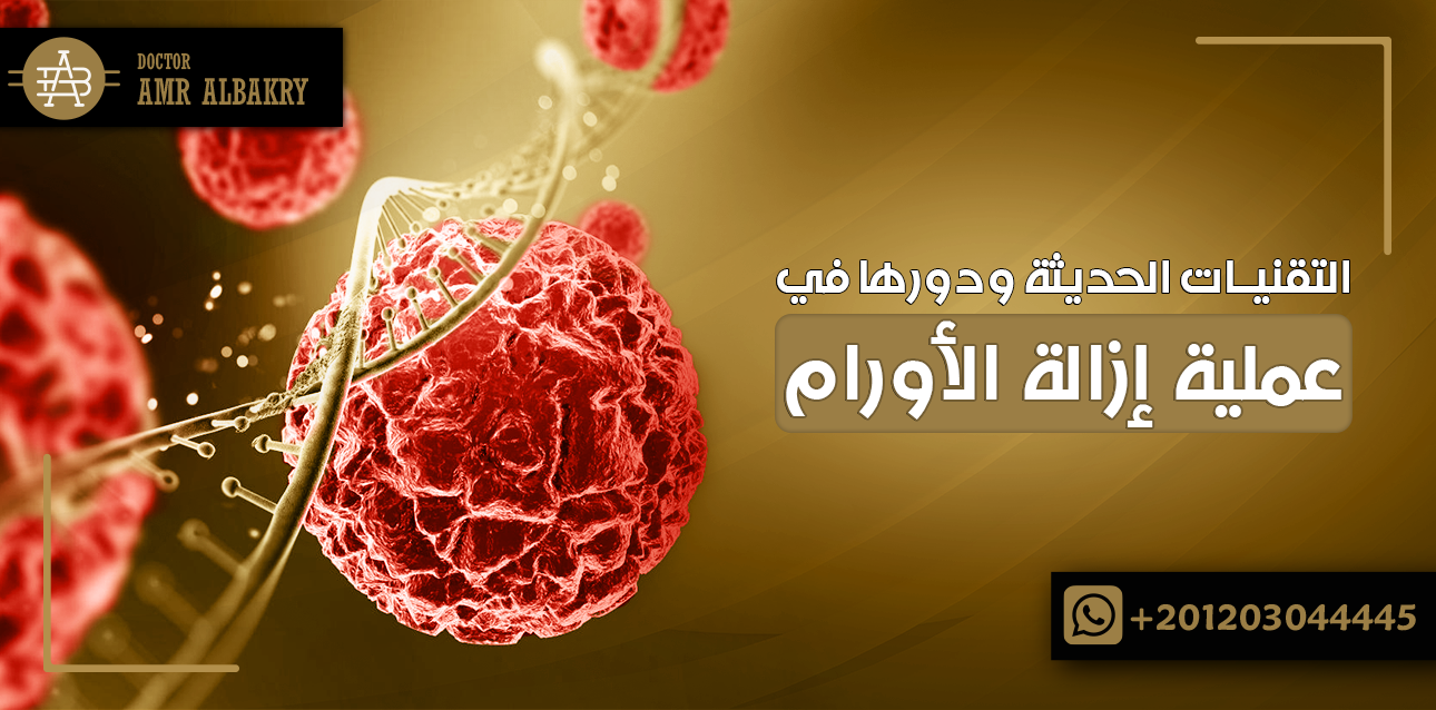 عملية إزالة الأورام