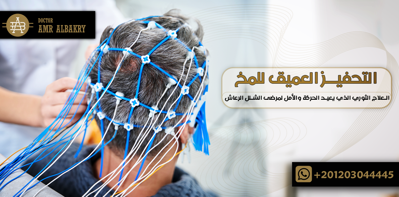 التحفيز العميق للمخ