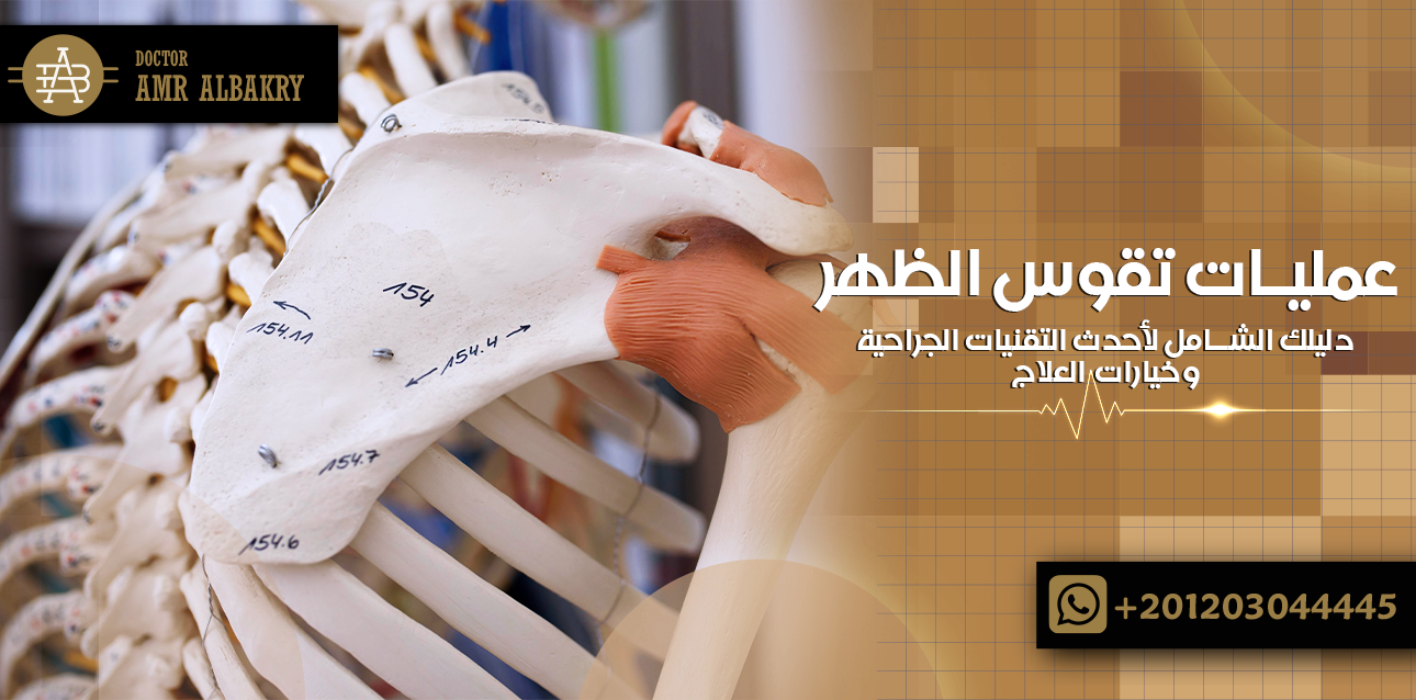 عمليات تقوس الظهر